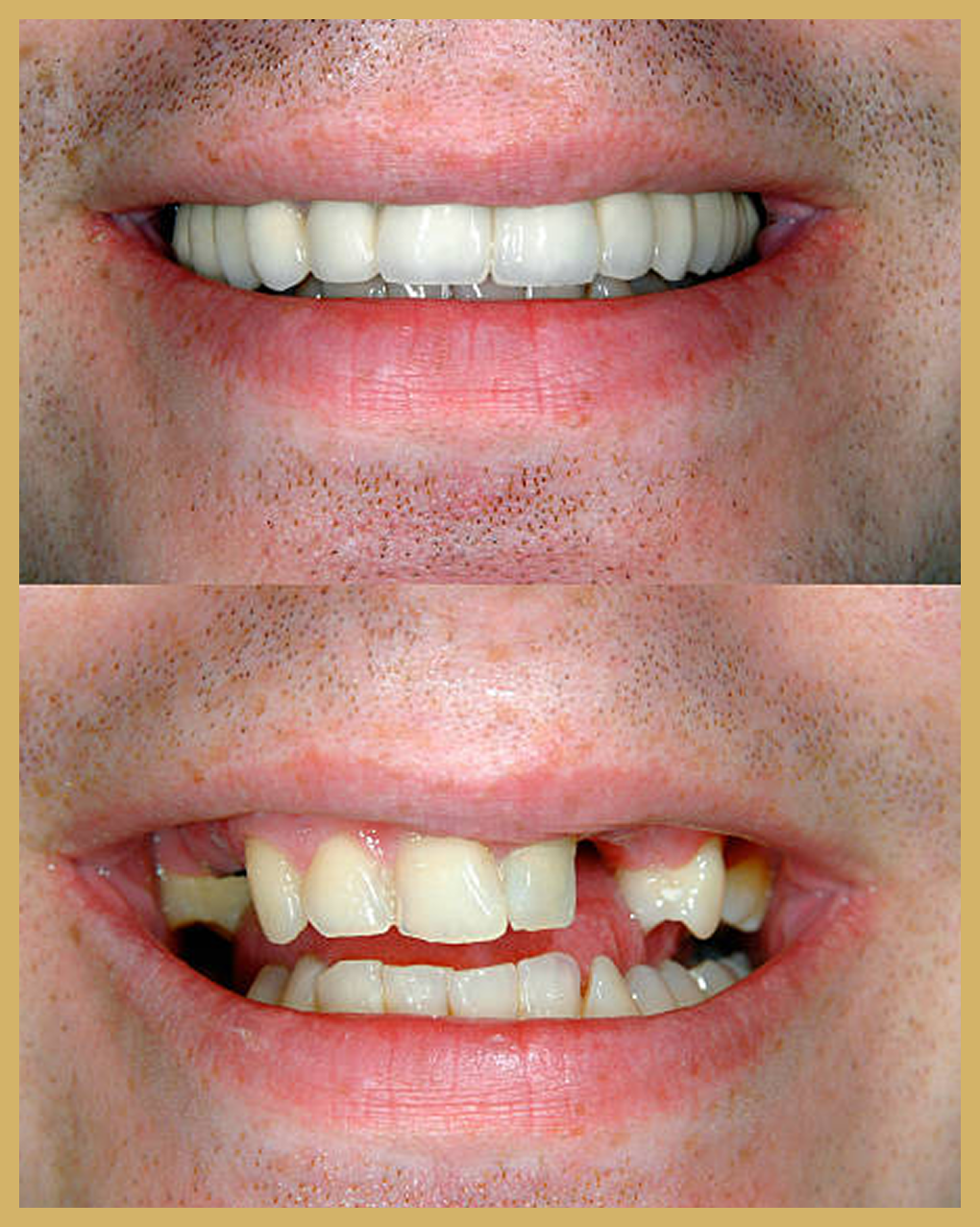 Before and after result