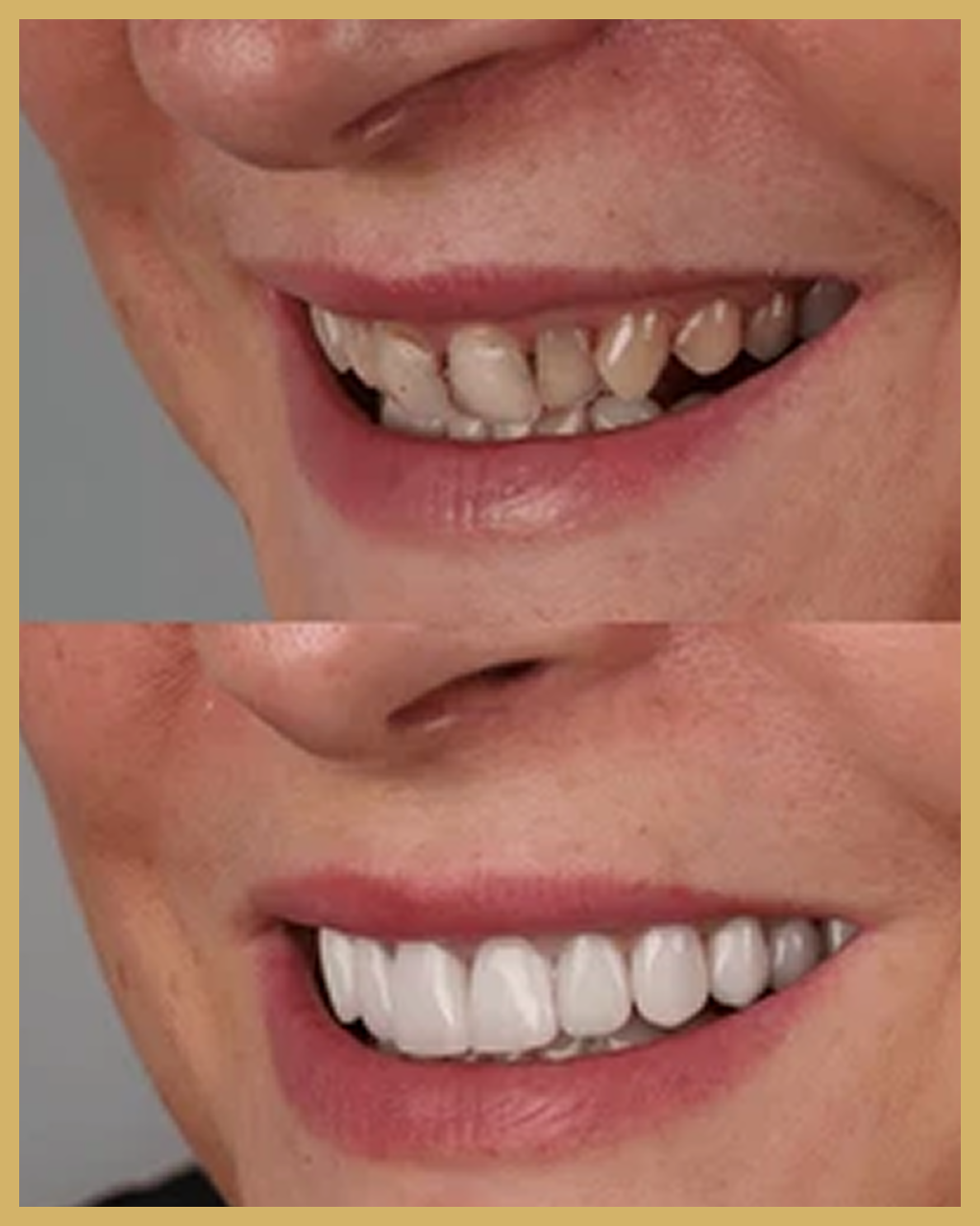 Before and after result
