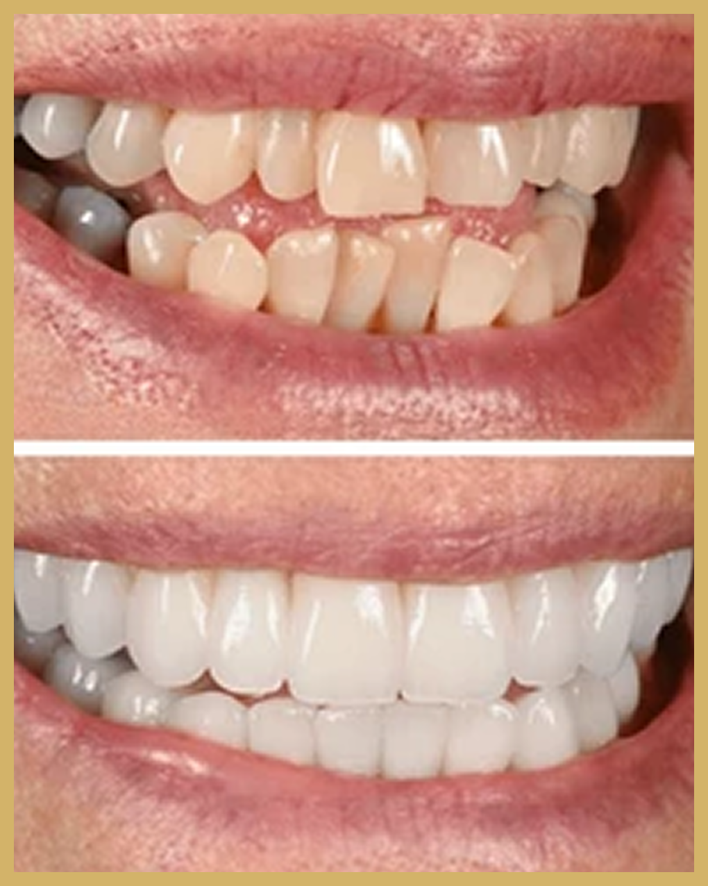 Before and after result